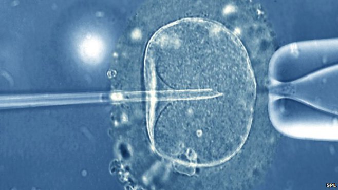 SPL (Science Photo Library)'s image: In vitrio fertilization light microscope. (2015) via BBC News, used w/o permission.